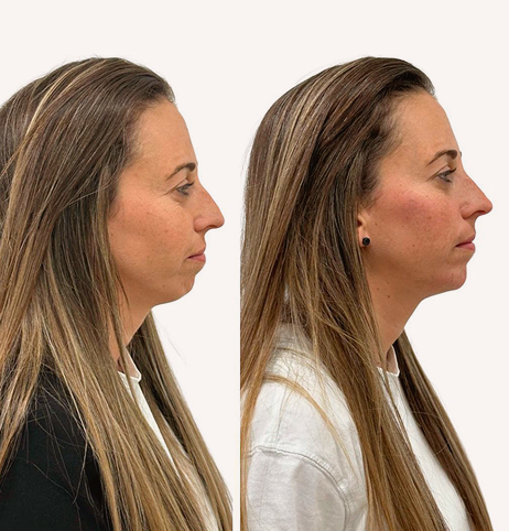 restructuracion dinamica