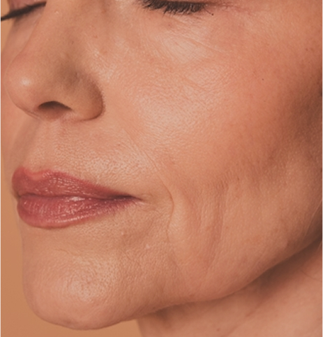 Sandra_Grohs_Tratamientos_Estetica_Facial