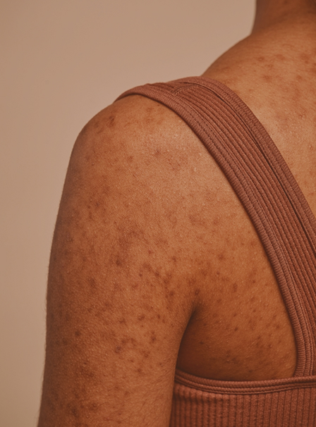 Medicina_Estetica_Murcia