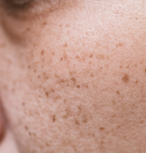 Medicina_Estetica_Murcia