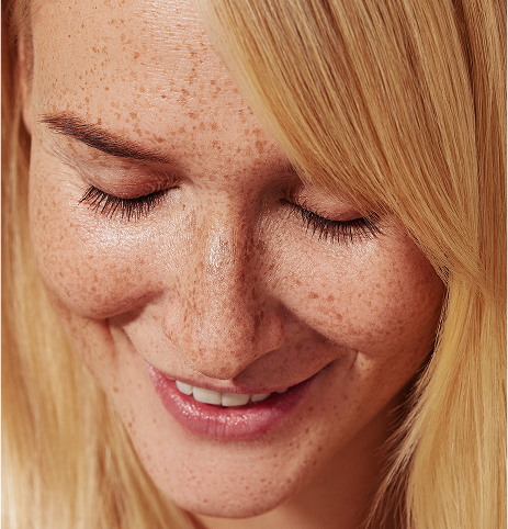 Medicina_Estetica_Murcia